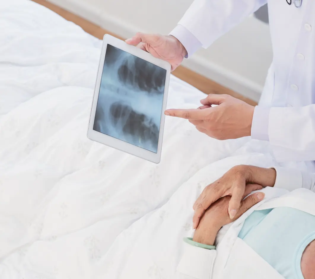 x-ray