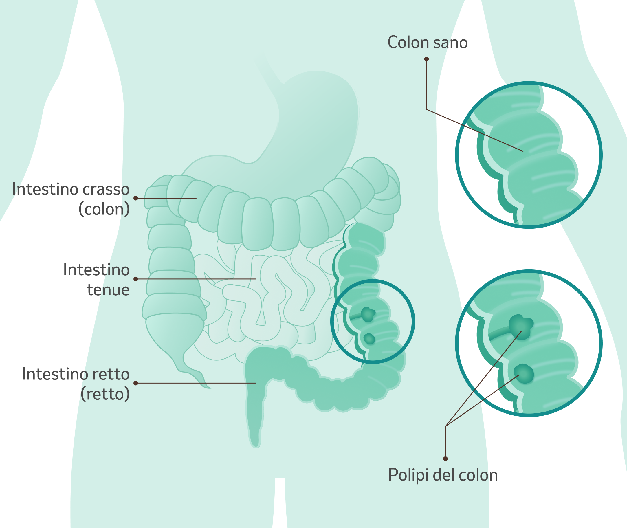 illustrazione dell'intestino con spiegazione